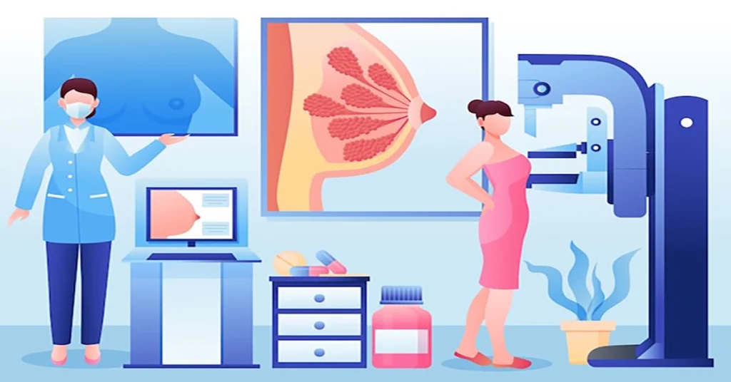 Illustration of a woman getting a mammogram, a key procedure for early breast
cancer screening and detection.